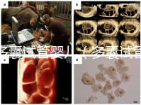 多囊試管嬰兒（多囊試管嬰兒成功率高嗎）