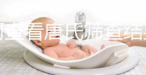 如何查看唐氏篩查結(jié)果，珠海醫(yī)院價(jià)格二百四起