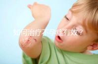 如何治療不孕癥有效？