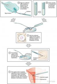 婦科病癥狀（婦科病癥狀表現有哪些呢）