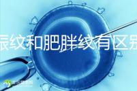 妊娠紋和肥胖紋有區(qū)別，教你3種“花紋”診斷鑒別的方法