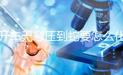 開車無意壓到蛇要怎么化解進來瞧,要不要報警一目了然