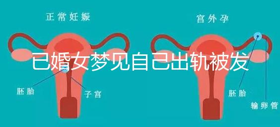 已婚女夢(mèng)見自己出軌被發(fā)現(xiàn)什么意思來(lái)瞧,或和心理有關(guān)系