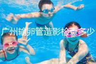 廣州輸卵管造影檢查多少錢，預(yù)約時(shí)間一次說清楚，想去看