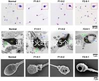 造成肝火旺的這5個原因,你都知道嗎?