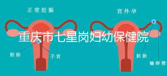 重慶市七星崗婦幼保健院做試管需要多少錢?可以用醫(yī)療保險(xiǎn)嗎?