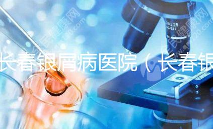 長(zhǎng)春銀屑病醫(yī)院(長(zhǎng)春銀屑病醫(yī)院哪個(gè)最好)