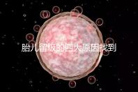 胎兒留級的四大原因找到了！多半和媽媽太懶不運動有關(guān)系