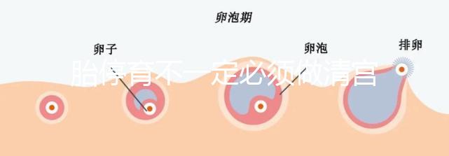胎停育不一定必須做清宮!不滿足這3種情況,無需要刮宮