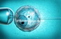 臍帶血捐贈后萬一自己要用怎么要早知，懷孕的趁早了解