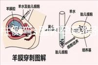 脊柱側(cè)彎s型懷孕莫慌張，能否順產(chǎn)還得看這4大要素