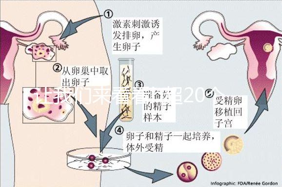 讓我們來看看b超20個卵子取10個是不正常的我們該怎么辦？