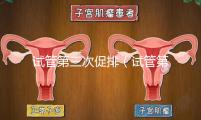 試管第三次促排（試管第三次促排多少錢）