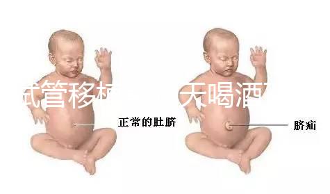 試管移植前幾天喝酒了有影響嗎？想要懷孕得管住嘴！