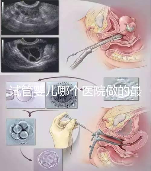 試管嬰兒哪個醫院做的最好呢？多家權威機構推薦