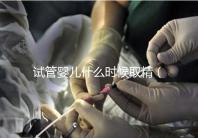 試管嬰兒什么時候取精（試管嬰兒什么時候取精是男孩的）