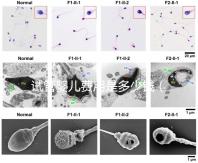 試管嬰兒費(fèi)用是多少錢(qián)（試管嬰兒費(fèi)用是多少錢(qián)一次）