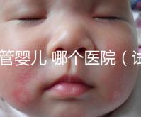 試管嬰兒 哪個(gè)醫(yī)院（試管嬰兒哪個(gè)醫(yī)院做的最好）