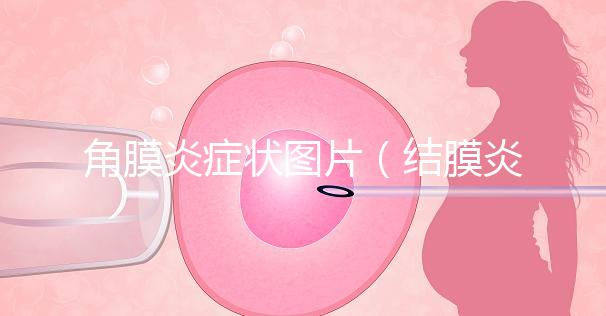 角膜炎癥狀圖片(結膜炎和角膜炎的區(qū)別)