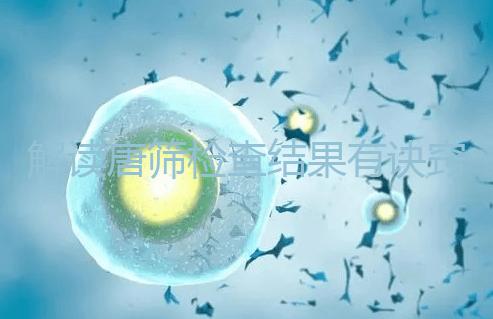 解讀唐篩檢查結(jié)果有訣竅，會(huì)看報(bào)告單上的正常值范圍是關(guān)鍵