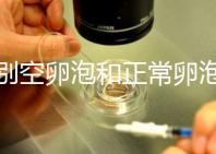 辨別空卵泡和正常卵泡是有技巧的，只需要了解這四個方面就可以輕松辨別，快速學習！