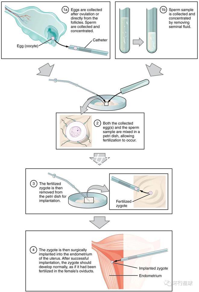貴陽未婚子女戶口如何向婦女介紹,附2024年結算流程