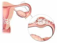 誰說華西二院試管嬰兒成功率不高，那是你沒選對生殖醫生