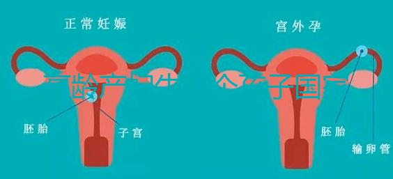 高齡產(chǎn)婦生八個(gè)孩子國家有補(bǔ)助？有沒有違法才是關(guān)鍵