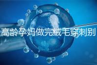 高齡孕媽做完絨毛穿刺別著急上班，臥床休息時(shí)間得這么久