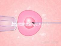 高齡能做試管嬰兒嗎？不是想做就能做得滿足這5個條件