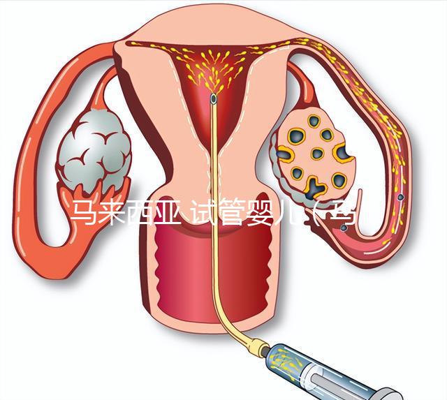 馬來西亞 試管嬰兒(馬來西亞試管嬰兒和泰國比較哪個更好)