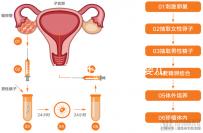 黃山市能不能做試管嬰兒？當地姐妹們這樣說