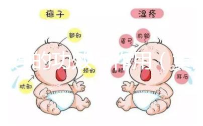 黃連的功效與作用(黃連片對(duì)男性性功能的效果)