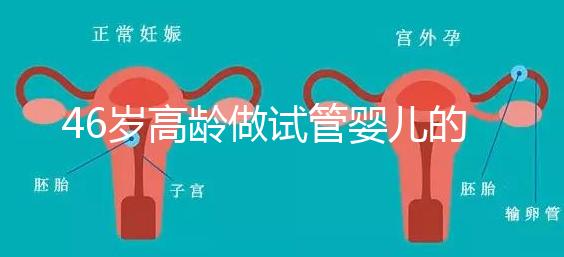 46歲高齡做試管嬰兒的成功幾率有多大?聽聽大家怎么說