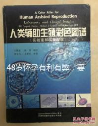 48歲懷孕有利有弊，要不要生需考慮這3點！