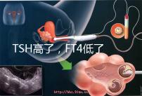 TSH高了，F(xiàn)T4低了，需要補碘嗎？