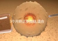 3個月矯正羅圈腿,適合成年人的變直雙腿的鍛煉方法