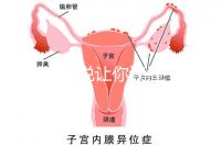 1分鐘解說讓你讀懂，排卵試紙白板一根線等各個反應