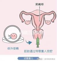 2024年西藏三胎新政策出臺(tái)，拉薩、日喀則產(chǎn)假戳多久？