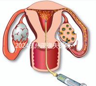 2024杭州邵逸夫醫院專家門診表，醫生上班時間一網打盡！