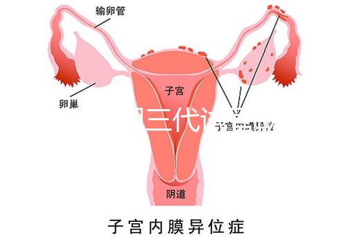 2025昆明三代試管助孕費(fèi)用一覽，8-15萬元，價格透明公開自主選擇
